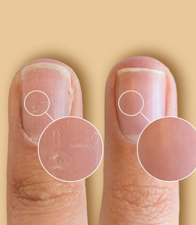 CND SolarOil Nail & Cuticle Treatment, 15 ml.
